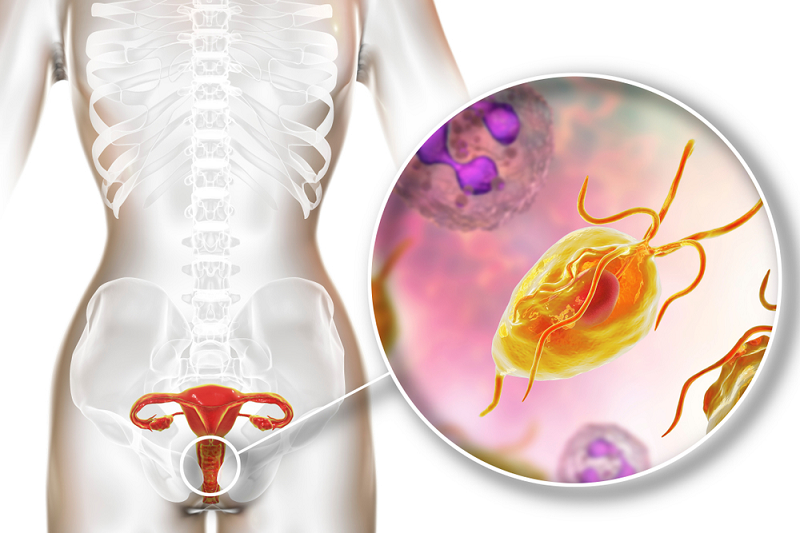 Trichomonas thường gây nhiễm khuẩn ở lớp biểu mô vảy đường sinh dục tiết niệu